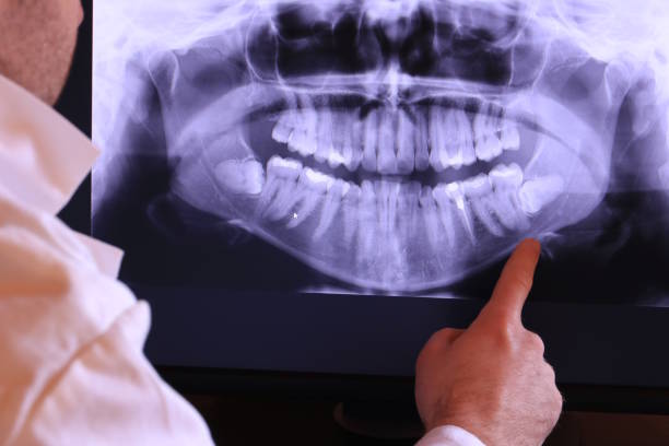 Best Emergency Denture Repair in Agua Fria, NM